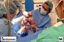 عکس/تولد دوقلوهای عاشق