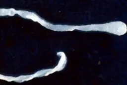 کرم 40 میلی‌متری در مغز یک مرد!/عکس