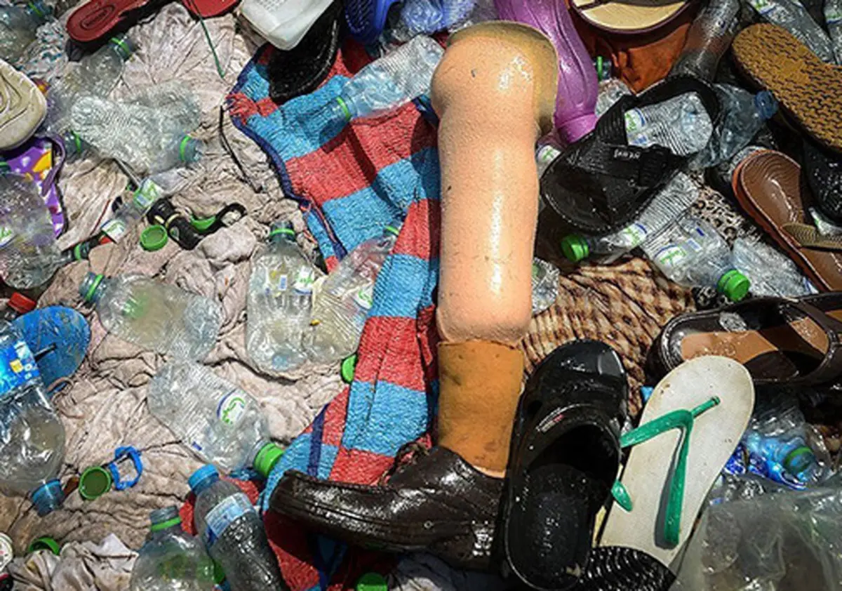 پایی که در منا جا ماند /عکس