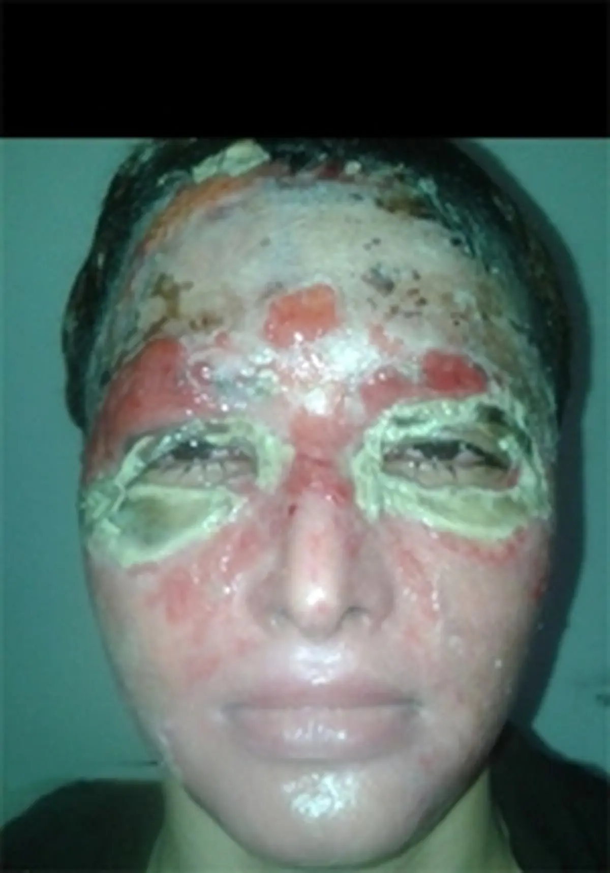 سزای پدری که به دخترش اسید پاشید+تصاویر