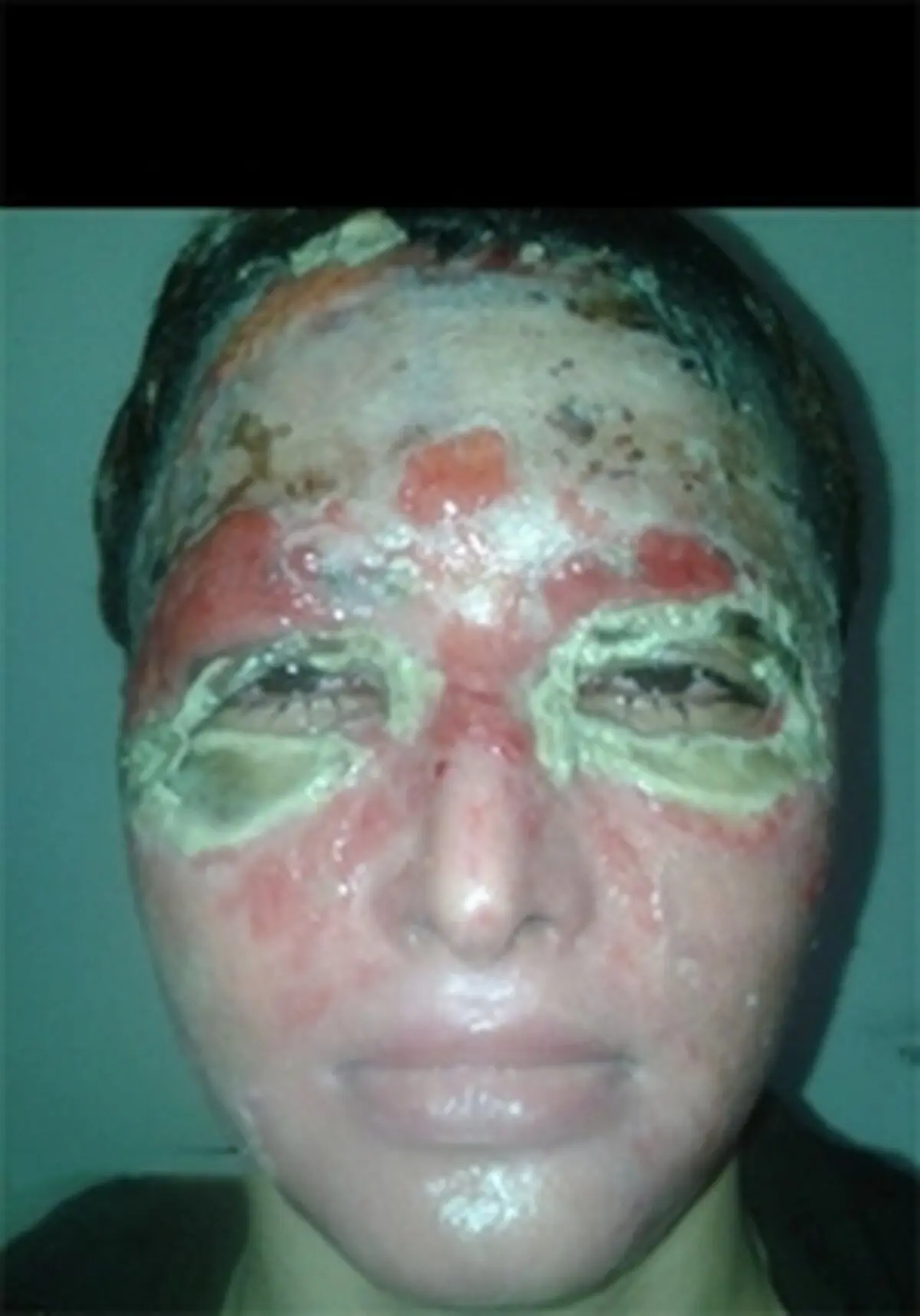سزای پدری که به دخترش اسید پاشید+تصاویر