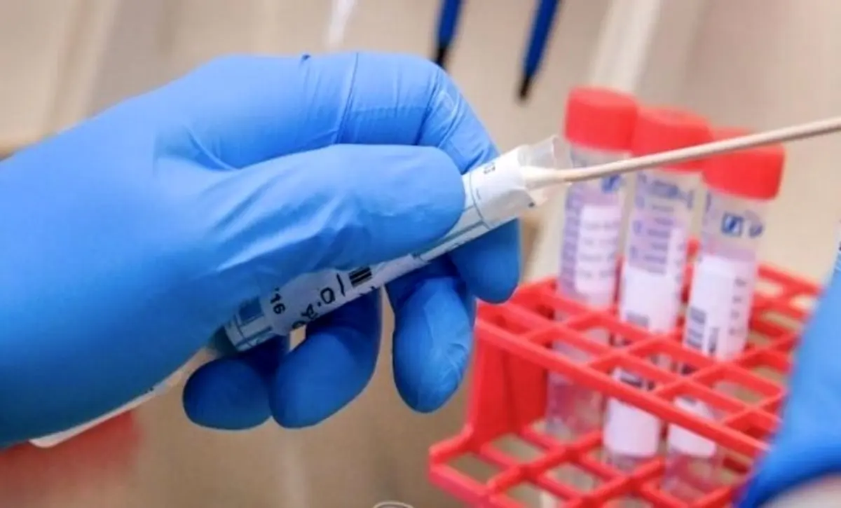 بیانیه دانشگاه علوم پزشکی جندی شاپور اهواز در خصوص مفقود شدن نمونه های تست کرونا