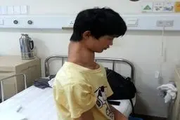 تصاویری از پسرگردن بلند چینی/ درمان پسر نوجوان آغاز شد
