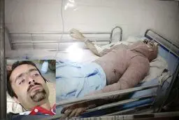 اسیدپاشی ​دو زن بر روی مرد جوان در هشترود+عکس