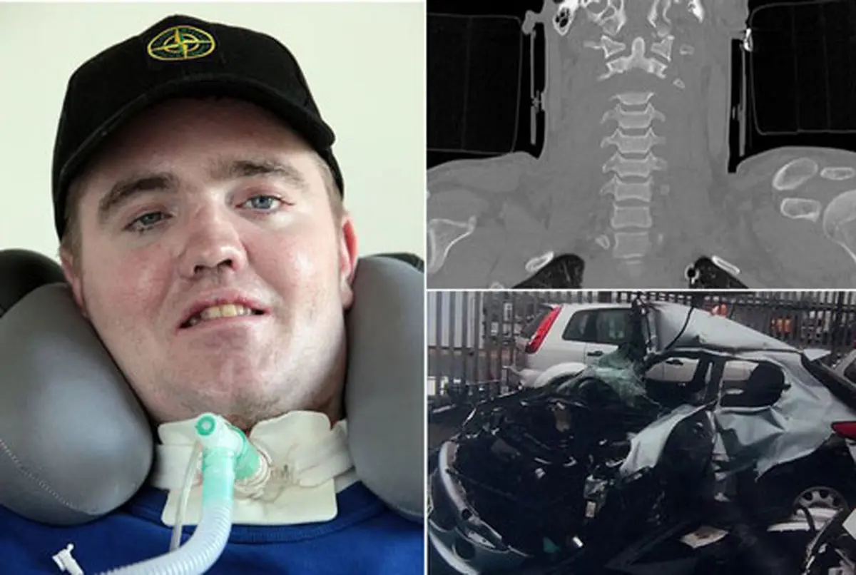 بازگشت به زندگی مردی که سرش قطع شد!/عکس