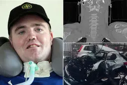 بازگشت به زندگی مردی که سرش قطع شد!/عکس