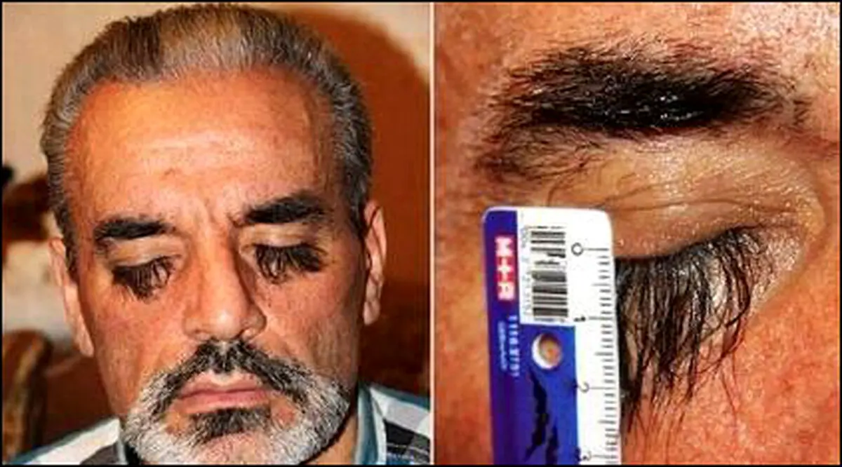 این مرد بلندترین مژه دنیا را دارد! +عکس