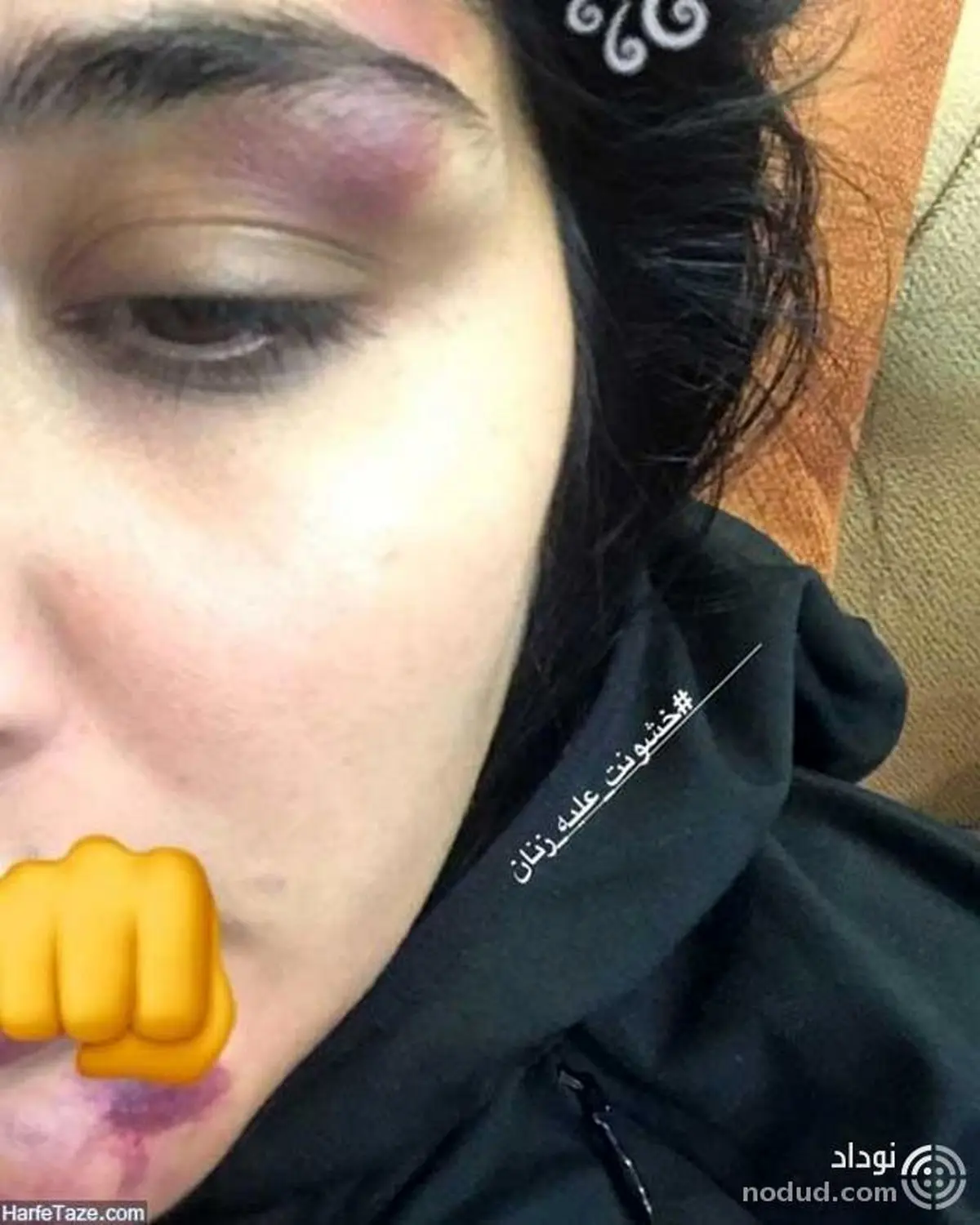 مریم معصومی را در خیابان کتک زدند / عکس