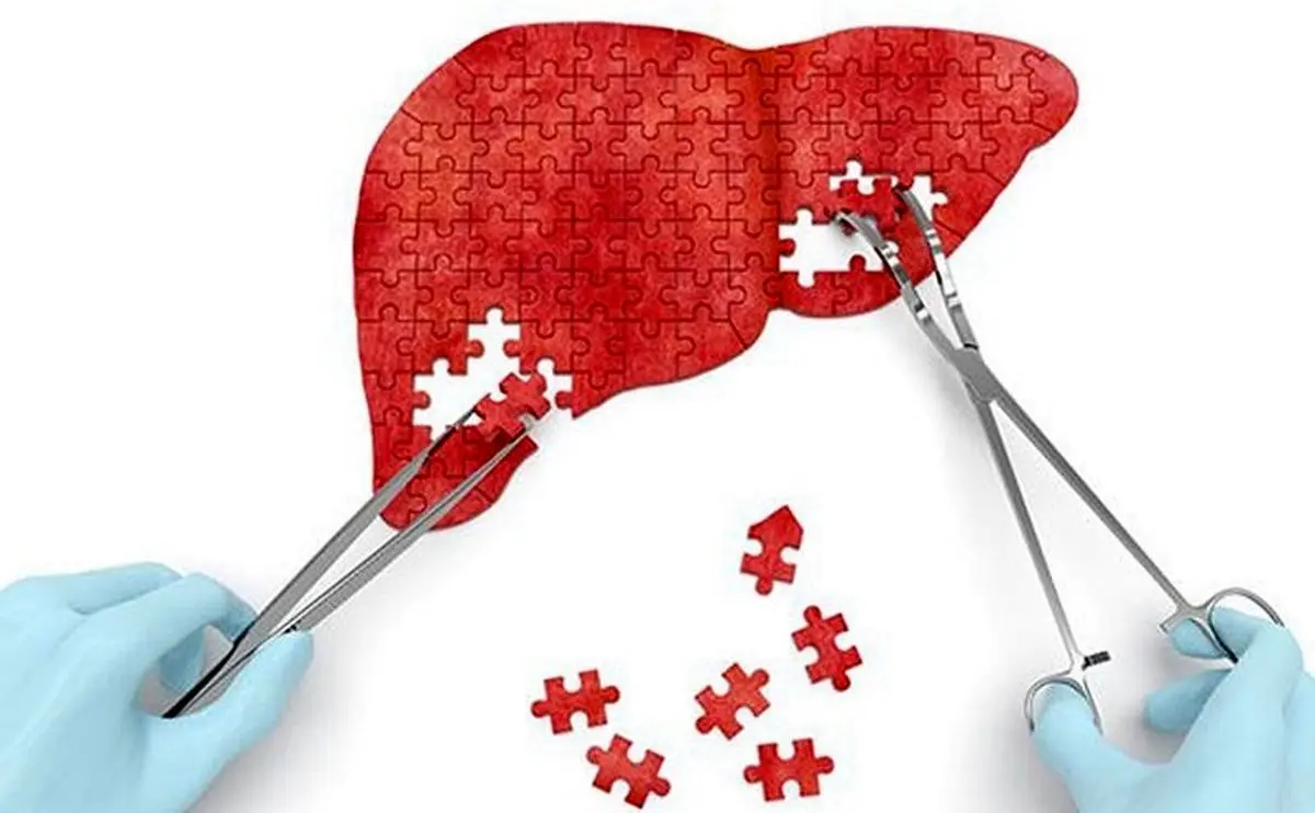 نشانه‌های پنهان اختلال کبدی