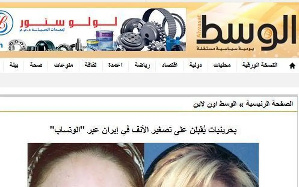 اقبال دختران و زنان بحرینی و کویتی به عمل زیبایی بینی در ایران با "واتس آپ"