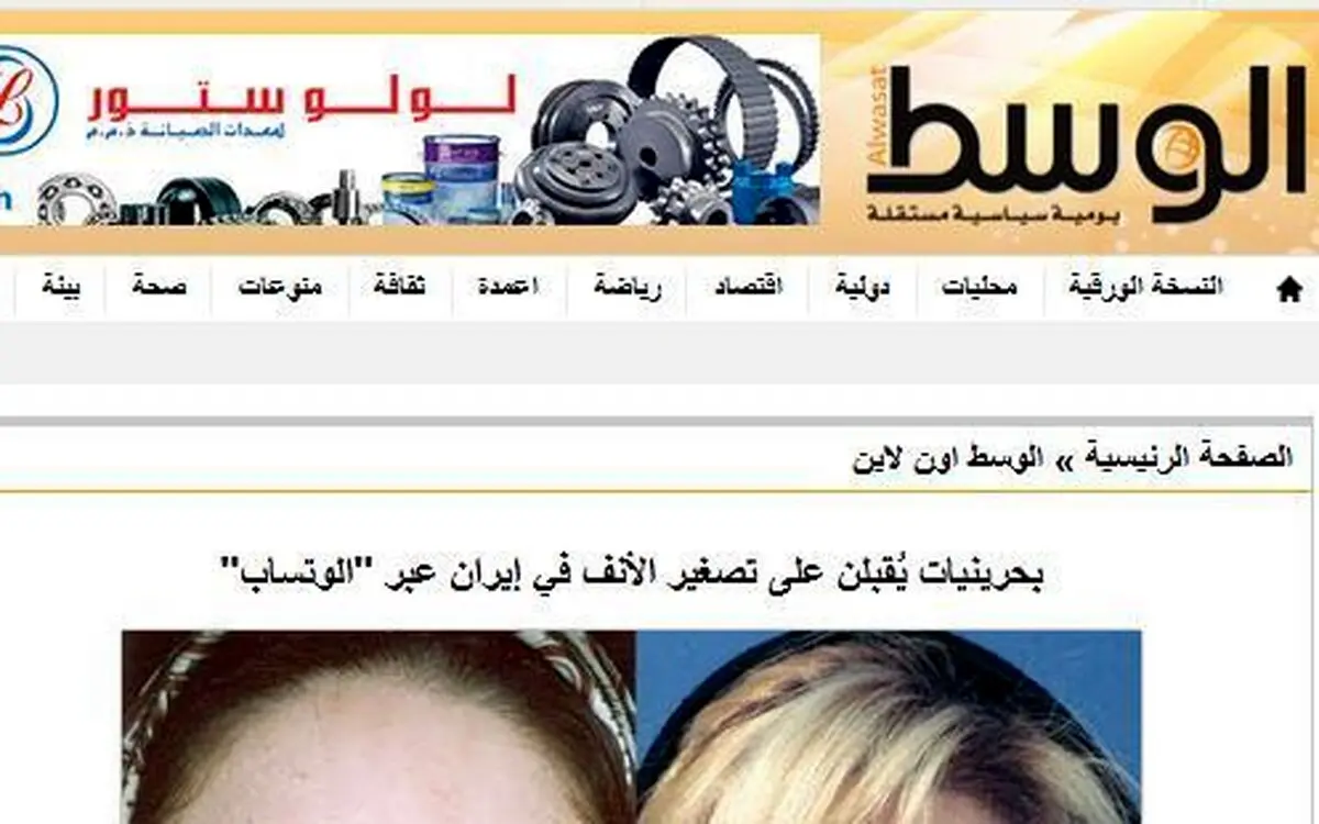 اقبال دختران و زنان بحرینی و کویتی به عمل زیبایی بینی در ایران با "واتس آپ"
