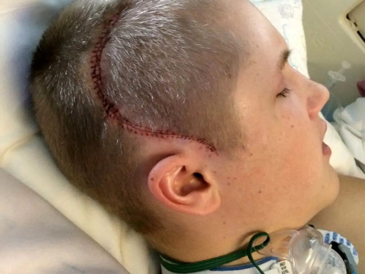 نجات معجزه‌آسای نوجوان ورزشکار