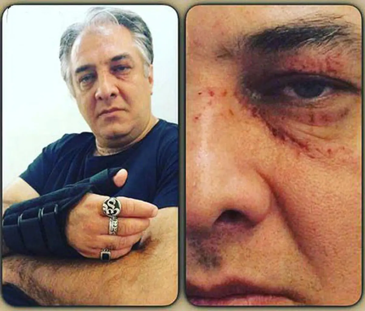 ایرج نوذری دچار سانحه شد /عکس