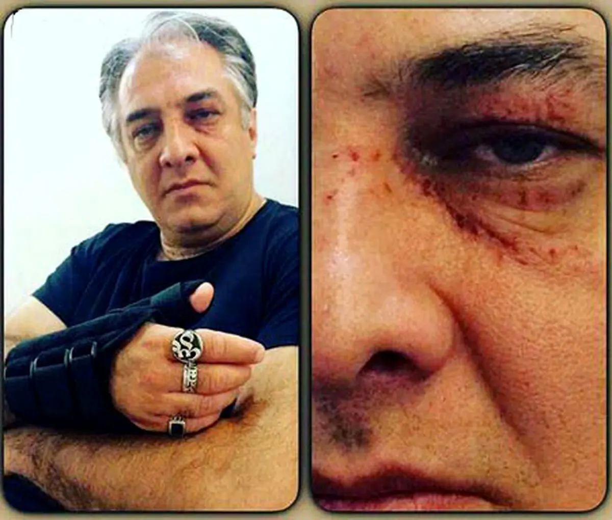 ایرج نوذری دچار سانحه شد /عکس