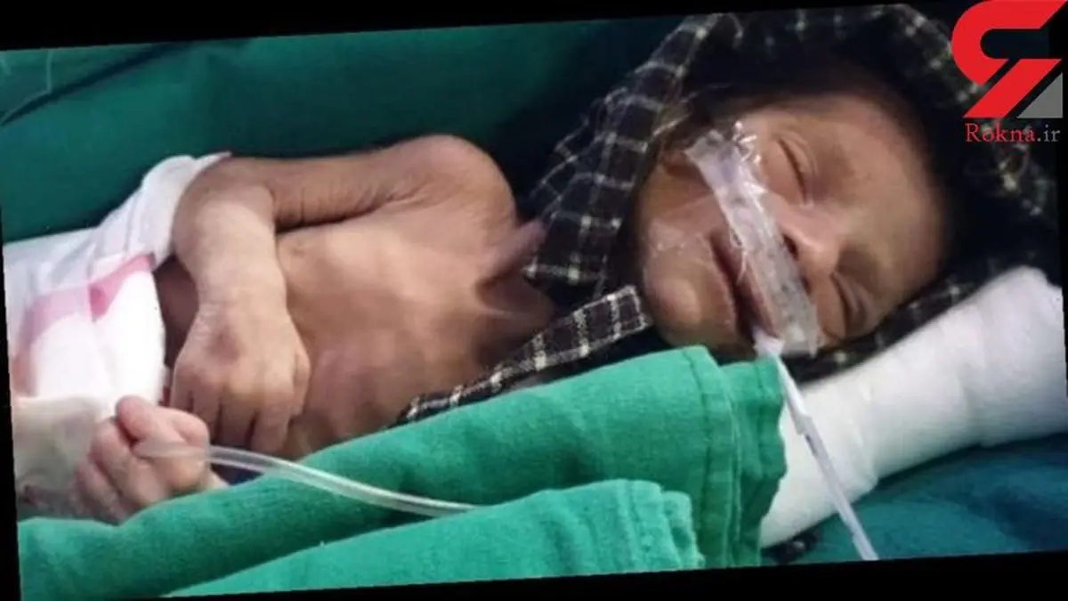 نوزاد دختر پس از ۲ روز در قبر زنده شد + عکس / هند