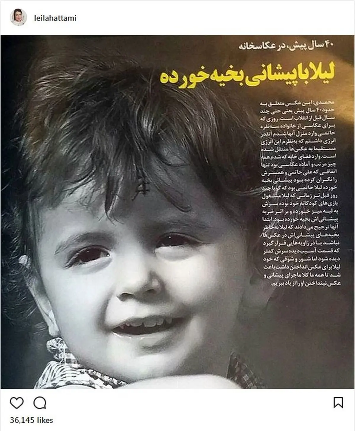 عکسی از لیلا حاتمی، با پیشانی بخیه خورده