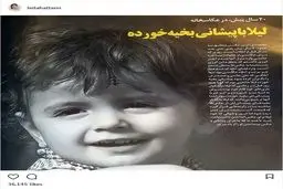 عکسی از لیلا حاتمی، با پیشانی بخیه خورده