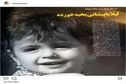 عکسی از لیلا حاتمی، با پیشانی بخیه خورده