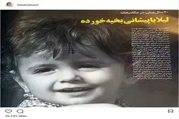 عکسی از لیلا حاتمی، با پیشانی بخیه خورده