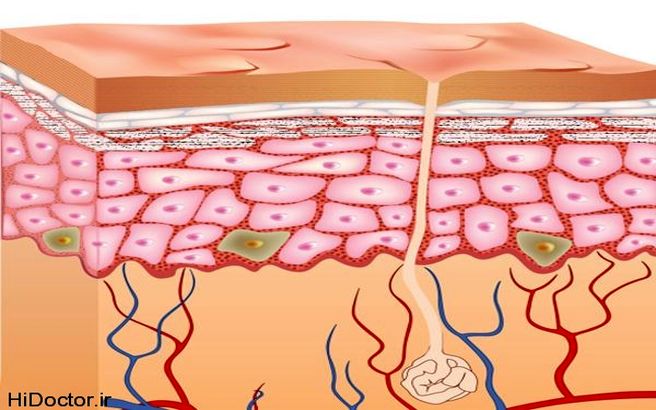 چرا منافذ پوست بزرگتر می شود و درمانهای طبیعی آن