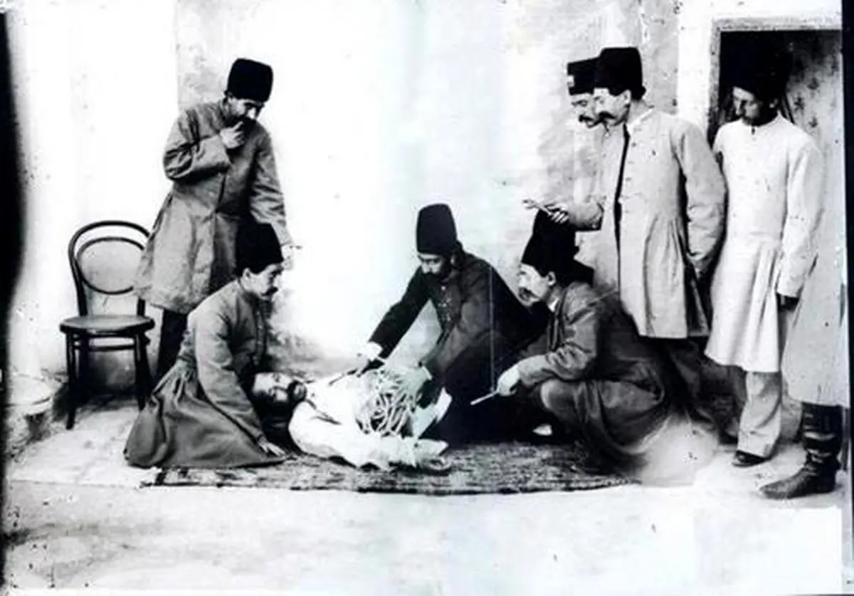کشیدن دندان با گازانبر در زمان قاجار/عکس