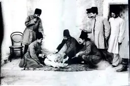 کشیدن دندان با گازانبر در زمان قاجار/عکس