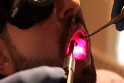 روشی برای مقابله با "عوارض جانبیِ درمان سرطان"