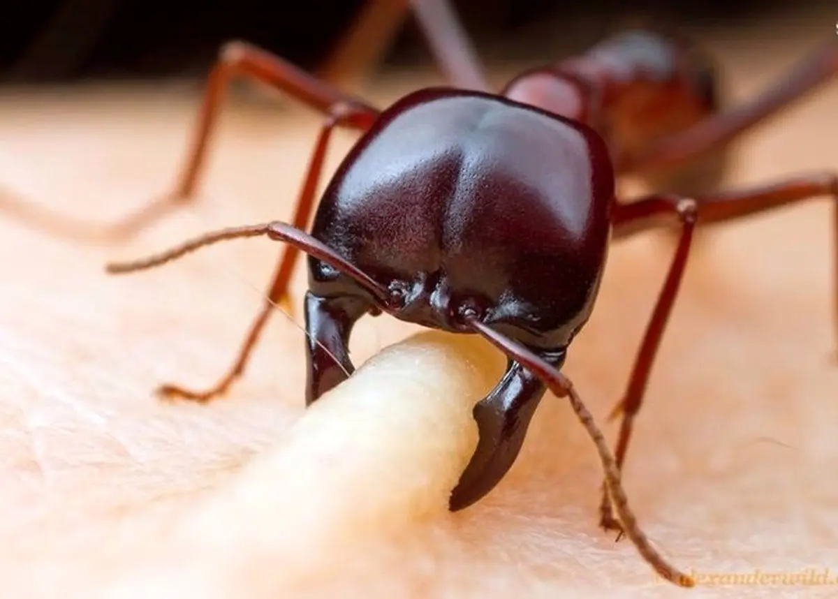 لحظه‌ای که مورچه انسان را گاز می‌گیرد!/ عکس