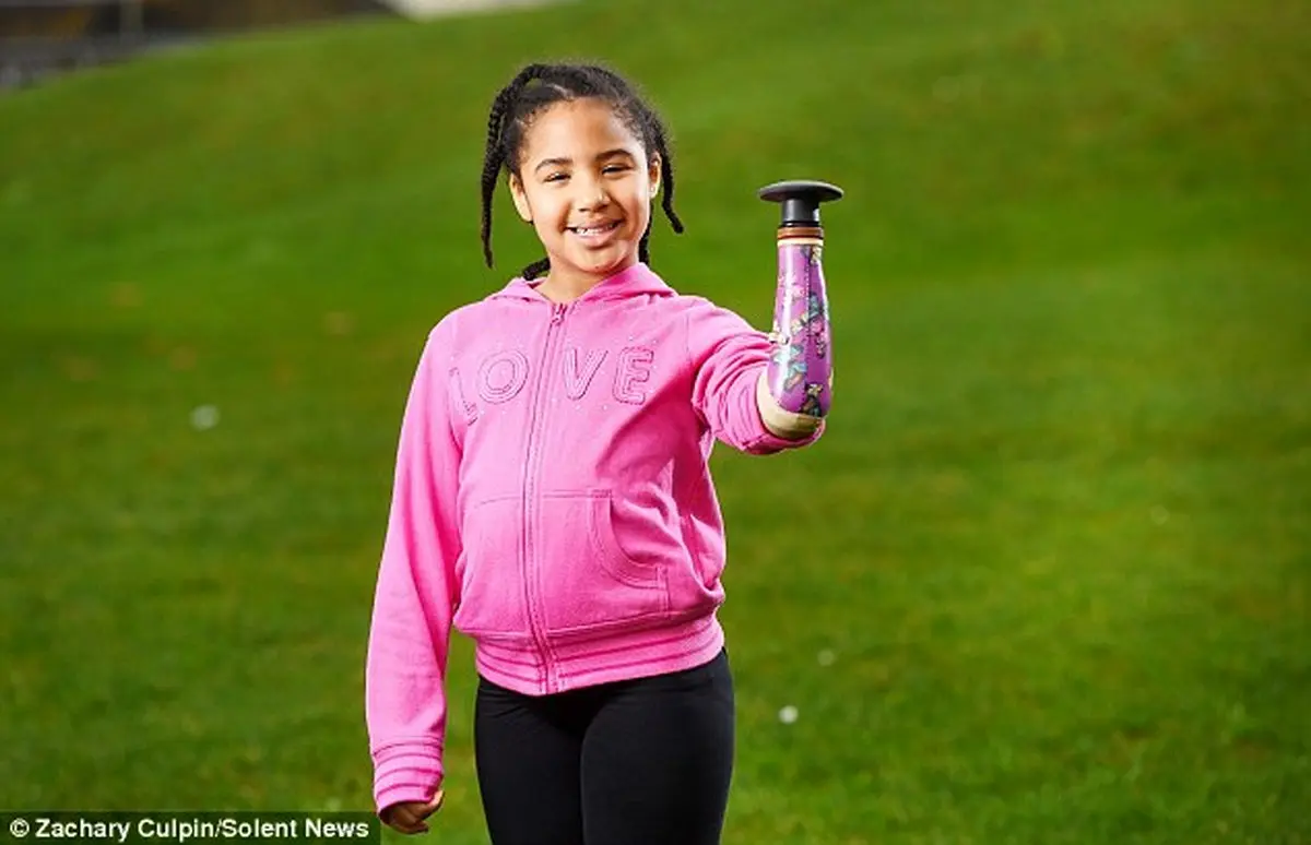 آرزوی دختر بدون دست محقق شد + تصاویر