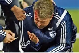 تماشاگری که مربی شالکه را مصدوم کرد+عکس