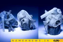 کاهش خطر جراحی قلب با کمک چاپ 3 بعدی+عکس