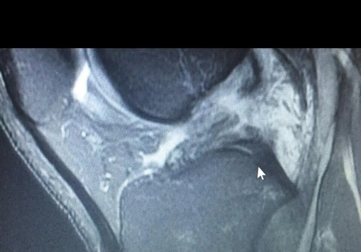 بهانه جدید النصری‌ها برای توجیه شکست مقابل پرسپولیس+عکس