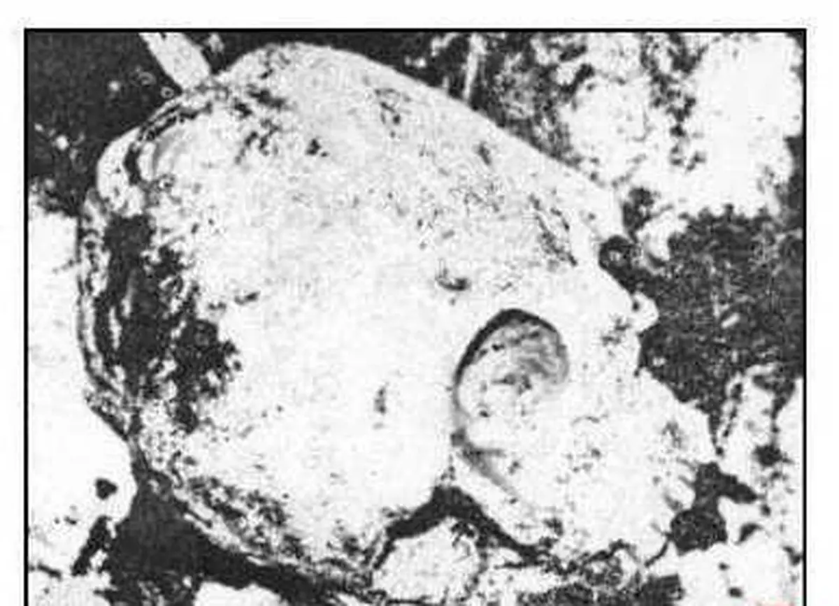 جمجمه نادر شاه افشار بعد از نبش قبر/عکس